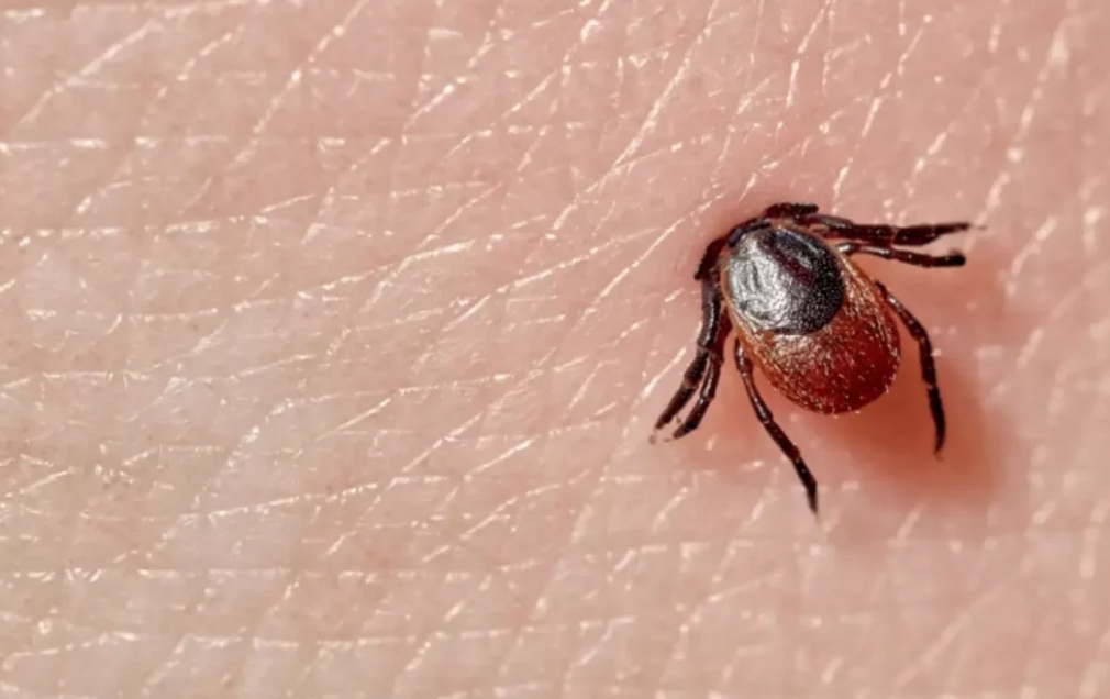 MS Tem Cinco Casos Suspeitos De Febre Maculosa O Progresso