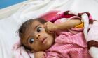 Agências pedem compromisso contínuo no auxílio a milhões de pessoas no Iêmen