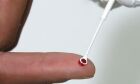 Saúde amplia vacinação contra o HPV para quem usa PrEP
