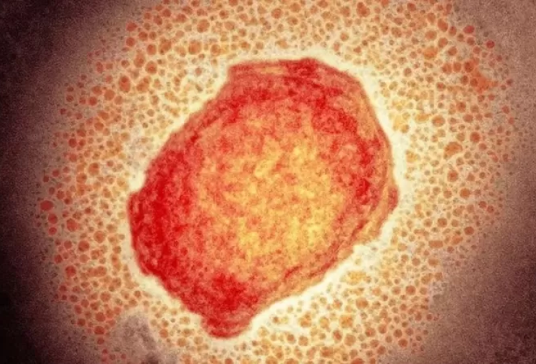 Exame confirma 1&ordm; caso de varíola dos macacos no Brasil
