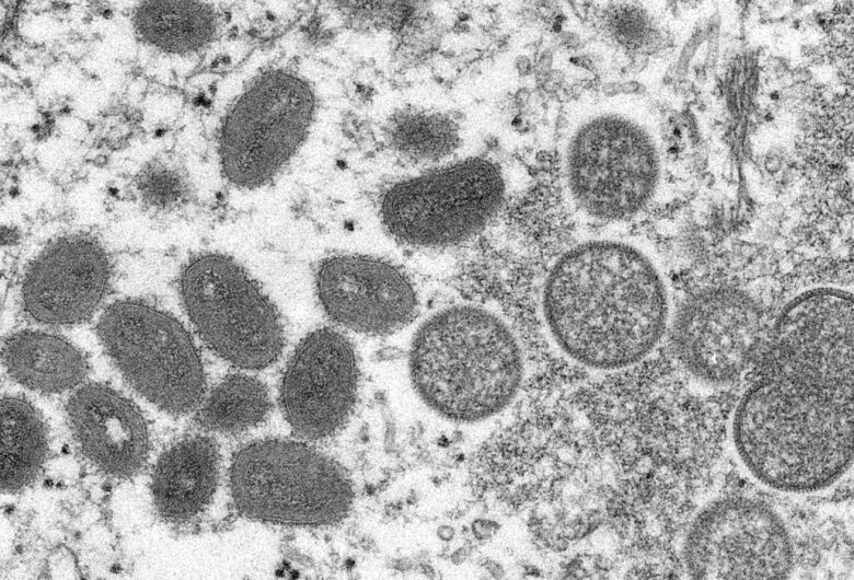 Fiocruz conclui sequenciamento genético do vírus Monkeypox