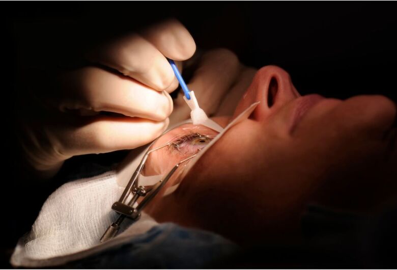 Expert cites doubts and risks of refractive surgery to get rid of glasses