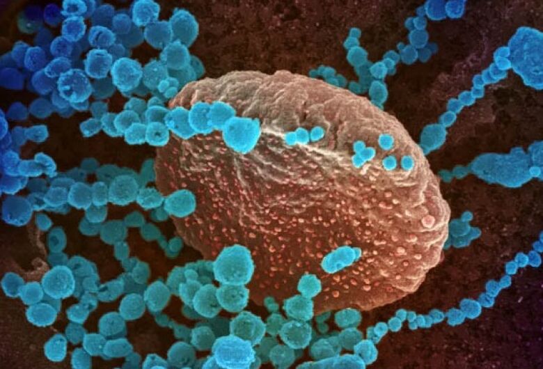 As causas da imunidade natural ao vírus da covid-19 ainda são desconhecidas