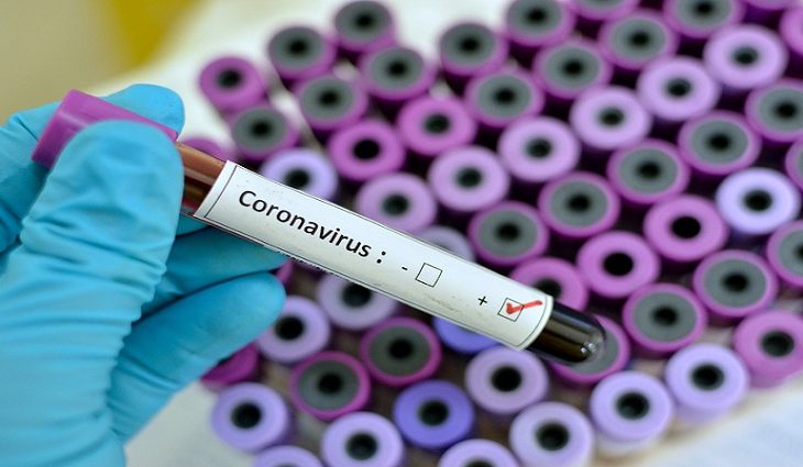 MS tem mais 429 novos casos confirmados de coronavírus - 