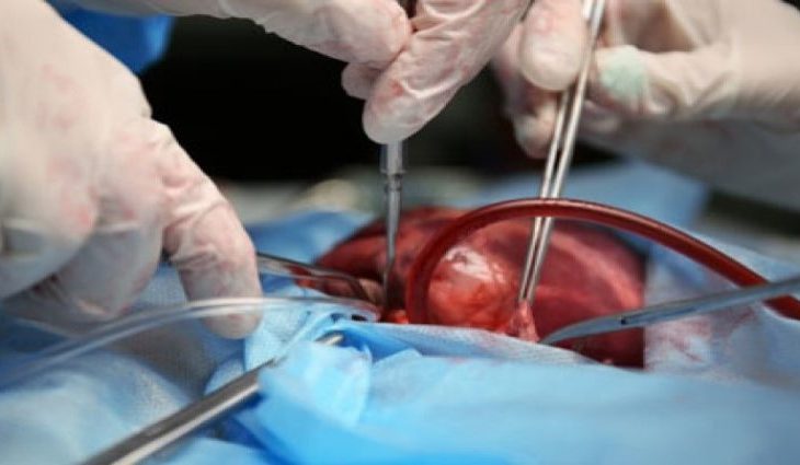 Fila do transplante de órgãos tem 428 pessoas em MS, mas recusa de famílias chega a 70% - Crédito: Divulgação