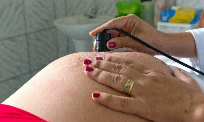 ANS lança campanha contra cesarianas desnecessárias - Crédito: Ana Nascimento/MDS/Portal Brasil
