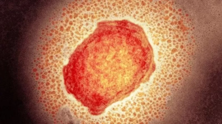 Exame confirma 1&ordm; caso de varíola dos macacos no Brasil
 - Crédito: SCIENCE PHOTO LIBRARY