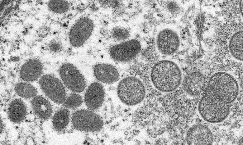 Imagem de microscopia do vírus da varíola dos macacos - Crédito: Cynthia S. Goldsmith/CDC
