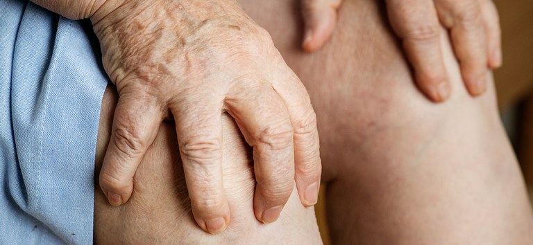 Artrite reumatoide: diagnóstico e tratamento imediato são fundamentais para controle da dor - 