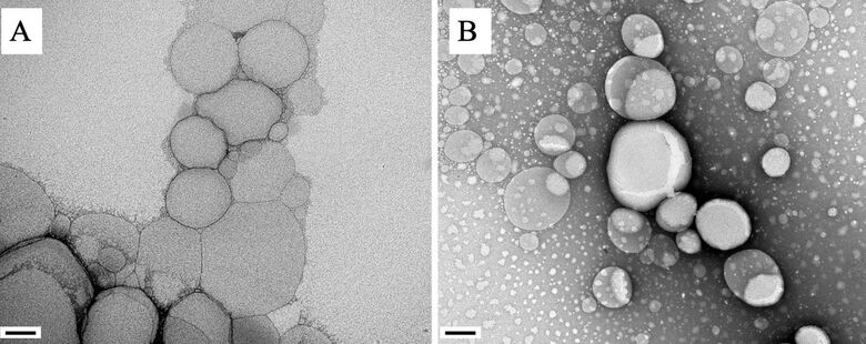 Nanopartículas lipídicas observadas em microscópio sem (A) e com (B) o princípio ativo encapsulado - Crédito: acervo dos pesquisadores