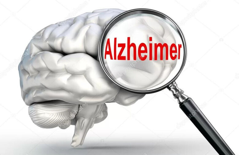 Estudo inovador sugere tratamento do Alzheimer duas décadas antes dos sintomas - 