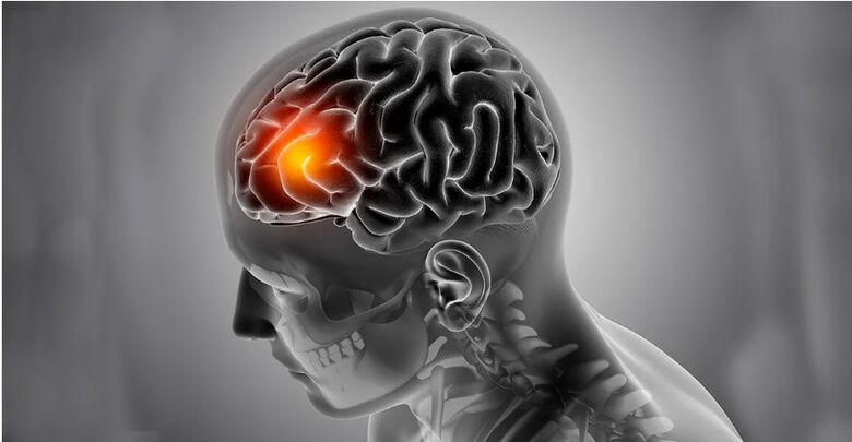 Acidentes vasculares cerebrais são a causa mais comum do acometimento do cérebro - Crédito: kjpargeter  Freepik
