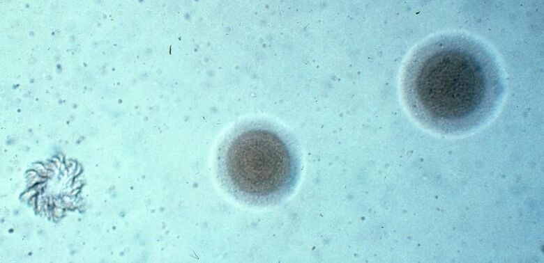À direita e ao centro, duas colônias de Mycoplasma pneumoniae e, à esquerda, uma "pseudocolônia" - Crédito: Microbe World/Flickr
