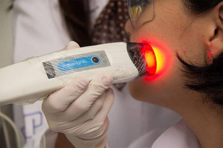 Terapia fotodinâmica não invasiva para câncer e pele foi criada por cientistas do Instituto de Física de São Carlos da Universidade de São Paulo  - Crédito: Divulgação/Cepof