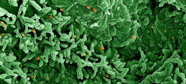 O vírus mpox (laranja) infecta células mostradas em verde - Crédito:  Niaid 