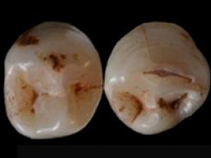 Dentes pré-históricos em Israel
 - Crédito: Foto: Rolf Quam / Binghamton University