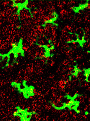 Células imunes, marcadas em verde fluorescente,
cercadas pelas nanopartículas - Crédito: Foto: Peter DeMuth e
James Moon / MIT