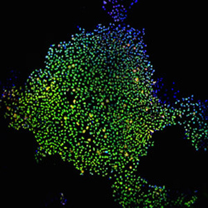 Foto traz células adultas induzidas à pluripotência
 - Crédito: Foto:James Thomson/Universidade de Wisconsin