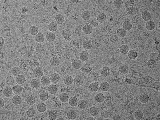 Imagem feita com crioscopia eletrônica do vírus da zika - Crédito: Foto: Universidade Purdue/Divulgação