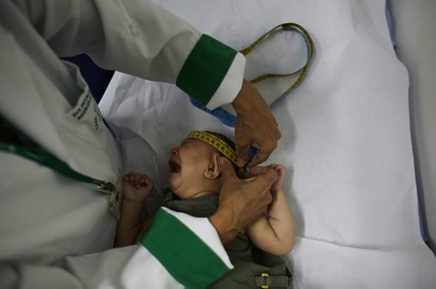 País tem 1.581 casos confirmados de microcefalia - Crédito: Foto: REUTERS/Nacho Doce