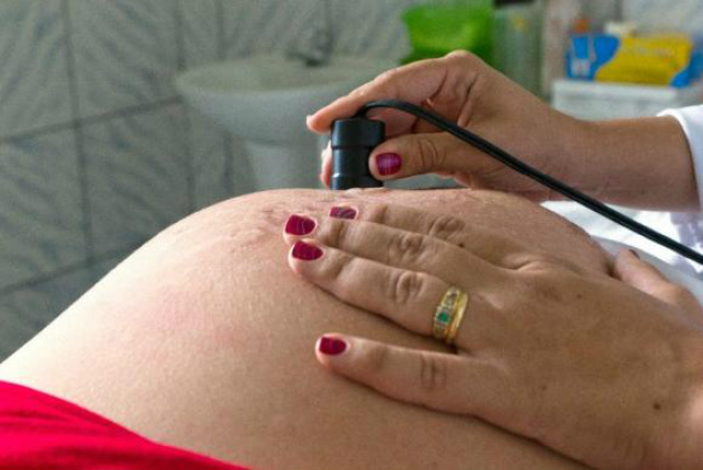 Para 70% das grávidas entrevistadas, os exames de ultrassom grávidas, gestantes, gestação, gravidezAna. - Crédito: Foto: Nascimento/MDS/Portal Brasil