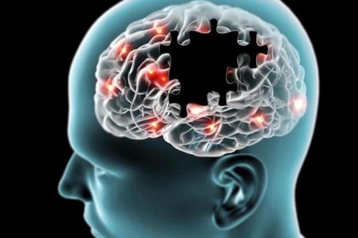 Cientistas de Cambridge descobrem novo método para combater Alzheimer - Crédito: Arquivo