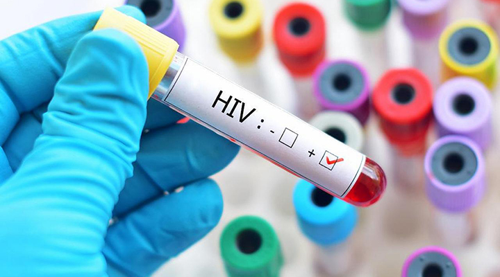 Pesquisa detalha distribuição dos subtipos do HIV no Brasil - Crédito: Divulgação