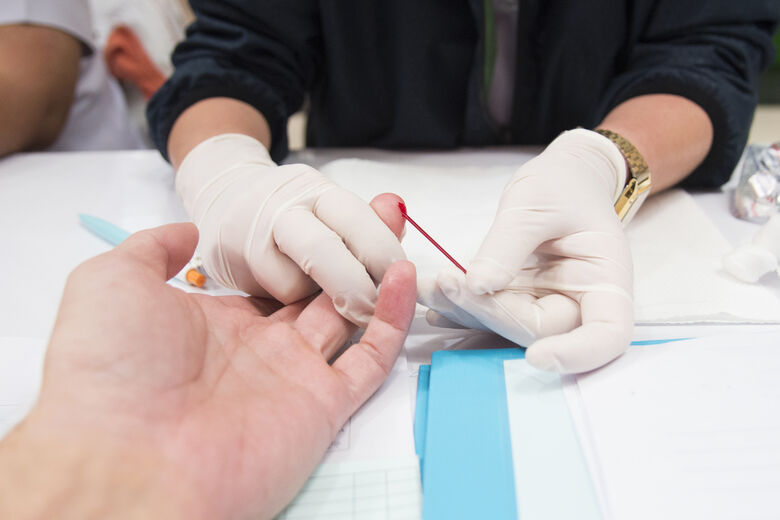 Ministério diz que cerca de 135 mil pessoas desconhecem que estão com HIV - 