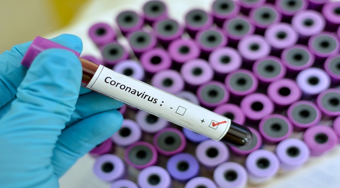 Sobe para 44 os casos confirmados de coronavirus em MS; Dourados segue com 2 - 