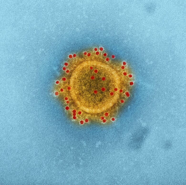 Imagem microscópica do coronavírus MERS-CoV, produzida pelo Instituto Nacional de Doenças Infecciosas e Alérgicas - Crédito: CDC/Unsplash