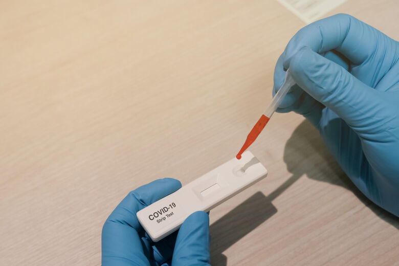 Pesquisadores desenvolvem testes rápidos para detectar coronavírus - Crédito: Imagem Ilustrativa