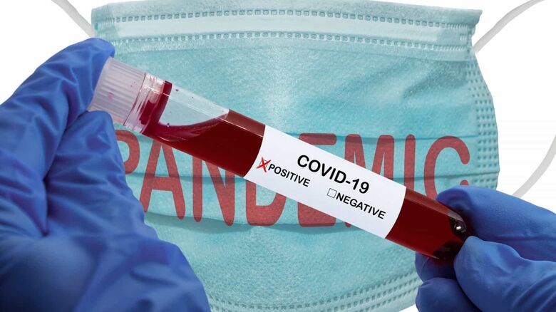 Secretaria de Estado de Saúde informa 20º óbito por coronavírus em MS - 
