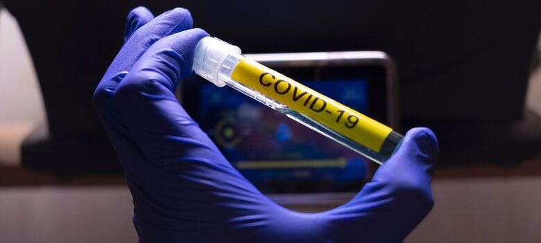 ONU pede solidariedade global para encontrar vacina acessível contra COVID-19 - Crédito: ONU/Loey Felipe