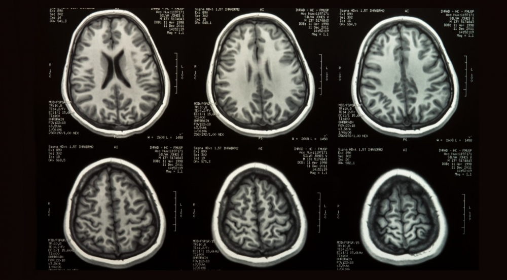 Bronstein - RM, Já imaginou um exame que pode detalhar todos os tecidos do  corpo em imagem, detectar cânceres, mapear a atividade cerebral e, ao  contrário do raio-X, não